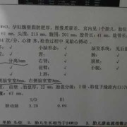 儿童没上户口如何查看核酸结果,检查胎儿是否畸形做什么检查