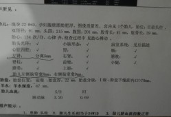 儿童没上户口如何查看核酸结果,检查胎儿是否畸形做什么检查