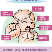 胎儿脱水（胎儿脱水什么意思）