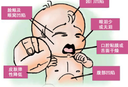 胎儿脱水（胎儿脱水什么意思）