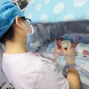 怀孕32周提前剖腹产宝宝能存活吗？我不知道应该要怎么办才好,32周的胎儿能存活吗?