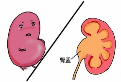 36周孕妇肾积水怎么办,孕36周胎儿肾积水怎么办