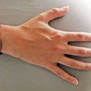 胎儿脐带绕颈如何矫正,胎儿脐带绕脖子怎么办