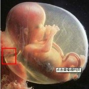 脐带连接胎儿哪里（脐带连接胎儿哪里图片）