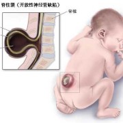 胎儿的脊柱（胎儿的脊柱一般都不会有问题吧）