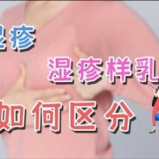 孕期乳头痒怎么办（孕期乳头痒怎么办呢）