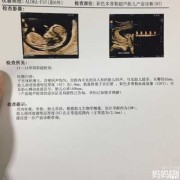 怀孕期间做nt检查什么（怀孕期间做nt检查什么项目）