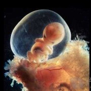 怀孕15周就有胎动正常吗,孕15周胎儿稳定了吗?我反应几乎没有了