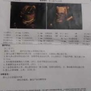 怀孕33周，还能做胎儿心脏彩超吗,胎儿心脏彩超挂什么科预约检查