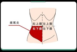 怀孕初期肚子有拉扯感的该怎么缓解才好的呢,孕期偶尔肚子疼正常吗
