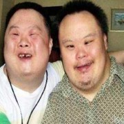 唐氏胎儿的症状（唐氏儿胎儿时的症状）