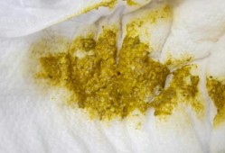 大便特别黏是怎么回事,孕期大便很黏很难解下来怎么办?