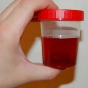 珊瑚黄瓜的来历,孕期尿黄红色