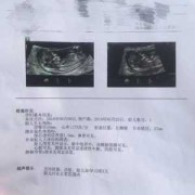 孕12周胎心率180正常吗,孕十二周胎儿真实图片欣赏