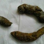 孕期梦到屎（孕期梦到屎是什么意思）