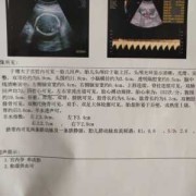 孕后期胎儿偏小怎么办（孕后期胎儿偏小的后果）