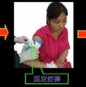 打保胎针一般打多久才能止血,孕期止血针有哪些