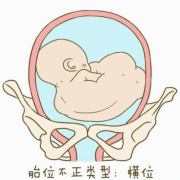 怎么知道宝宝面向你还是背对你,胎儿屁股朝右