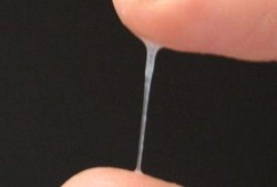 孕期流水一样的白带（孕期流水一样的分泌物）