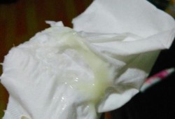 孕期白带像豆腐渣怎么回事（怀孕白带多像豆腐渣怎么办）