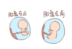 胎儿在前壁好还是后壁好（怀孕胎儿位于在前壁和后壁有什么区别吗）