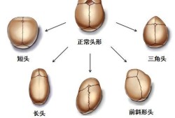 宝宝头骨发育过程,胎儿颅骨发育过程图