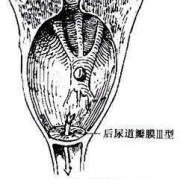 孕中期总感觉胎动已到尿道口是为什么,胎儿后尿道瓣膜是什么原因造成的