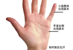 孕妇手指头麻是怎么回事,孕期手指麻木是什么原因引起的