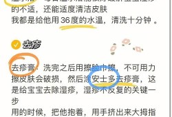 怀孕怎么预防胎儿湿疹（怀孕怎么预防胎儿湿疹复发）