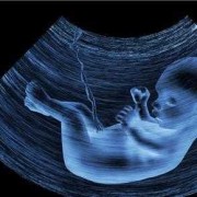 宝宝练习趴着抬头翻过来怎么翻,四维胎儿趴着怎么尽快转身
