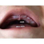 胎儿头半定（宝宝一岁半只长6颗牙，正常吗）