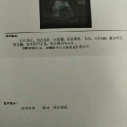 胎儿两个月没有胎心（胎儿两个月没有胎心是怎么回事）