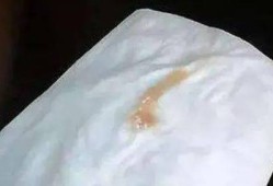 怀孕初期有黄色分泌物是什么原因,怀孕期间流黄色分泌物正常吗