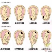 孕晚期胎儿位置图（孕晚期胎儿位置图片）