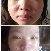 怀孕脸色发黄是什么原因,孕期脸色发黄怎么办呢