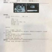 孕期nt检查（孕期nt检查什么项目）