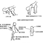 怀孕胎儿为什么会脑瘫,胎儿脑瘫原因有哪些