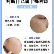 孕期怎样预防长斑（孕期怎样预防长斑长痣）