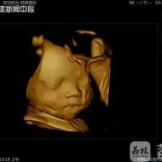 胎儿照相（胎儿照相馆）
