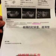 彩超做多了对胎儿有影响吗（b超体检多久做一次?做多了有什么坏处）