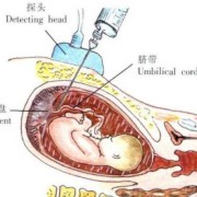 胎儿脐带血染色体检查（胎儿脐带血染色体检查多久出结果）