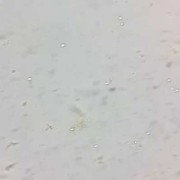 孕期有霉菌是生女孩吗（孕期有霉菌是生女孩吗还是男孩）