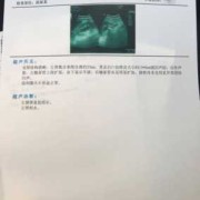 四维B超查胎内的胎儿肾不好,胎儿肾发育异常的原因有哪些