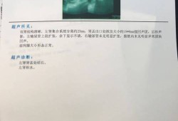 四维B超查胎内的胎儿肾不好,胎儿肾发育异常的原因有哪些