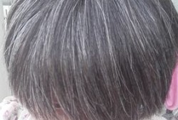 孕期头发白（孕期头发白）