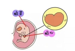 胎儿没有胎心的症状（胚胎停止发育的症状是什么）