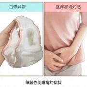 孕期细菌性阴炎怎么办（细菌阴道炎要怎么治）