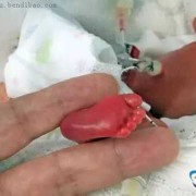 五个月宝宝哭闹不止怎么办？宝宝是怎么了呀,五个月胎儿的样子图片