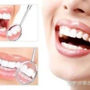 备孕期能洗牙吗（备孕期能洗牙吗有影响吗）