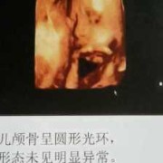 胎儿会睁眼睛吗（23周胎儿会睁眼睛吗）